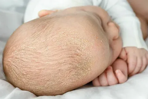Key factors that impact how quickly bald spots grow back
