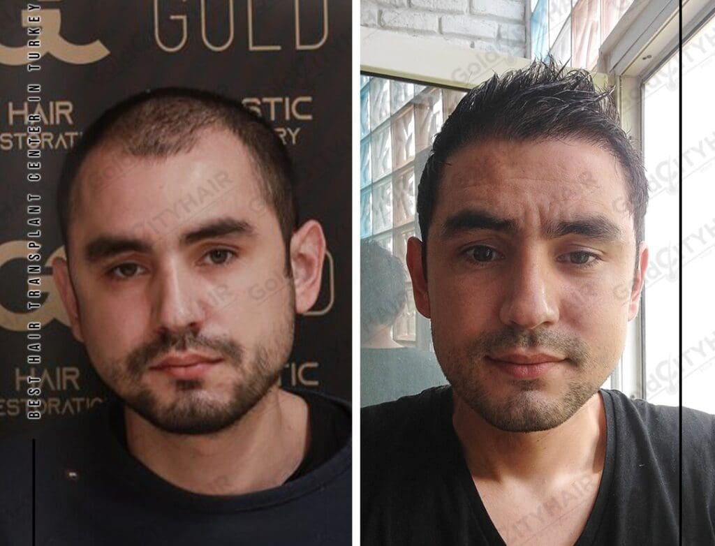 Understanding Dry and Damaged Hair