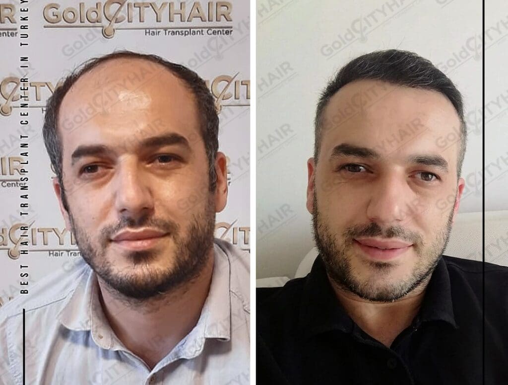 Best Supplements For Skin And Hair: 5 Wins