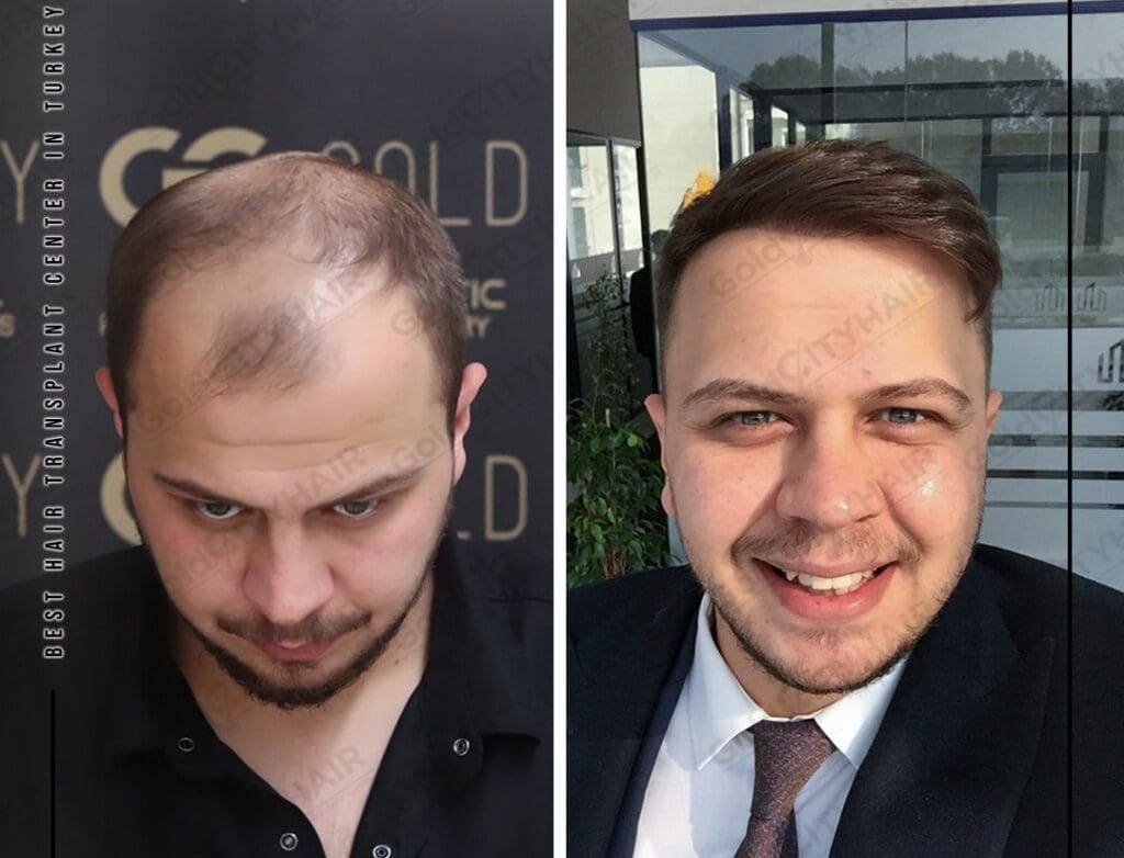 Understanding the Foundation of Hair Health