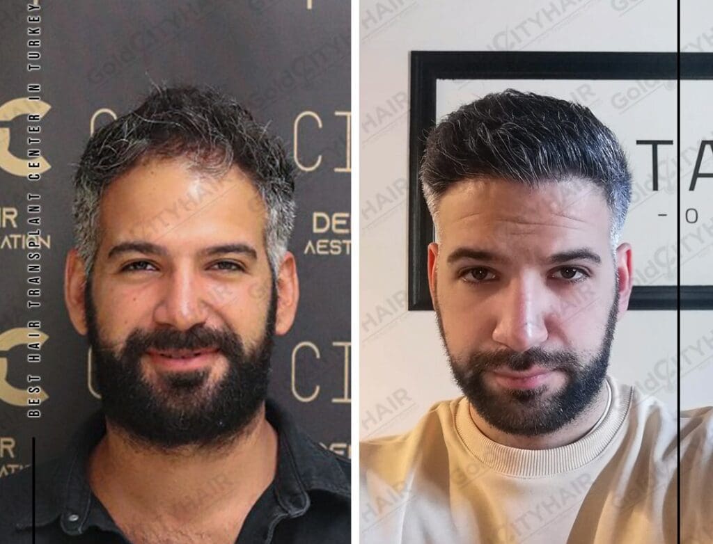 Understanding Hair Structure and Characteristics