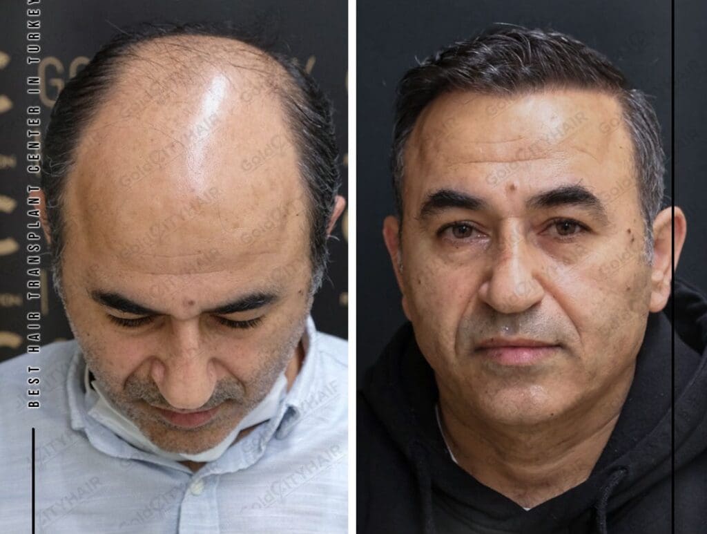 5 Evidence-Based Methods to Thicken Hair