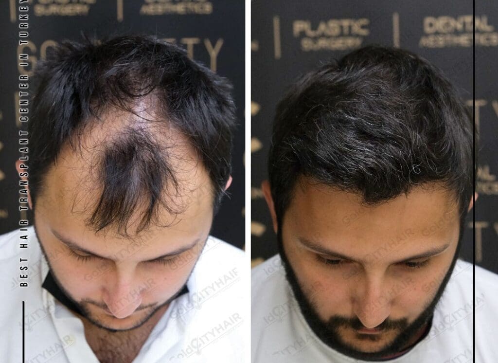 Key Haircare Practices for Maximum Length Retention