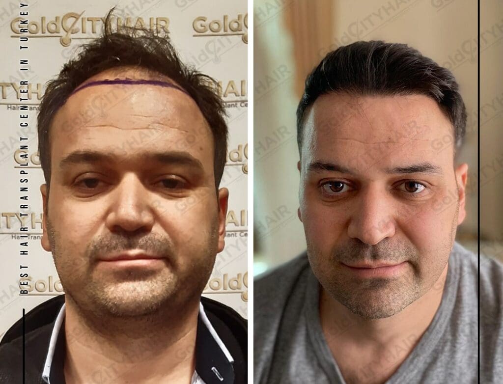 Understanding Hair Type Classifications