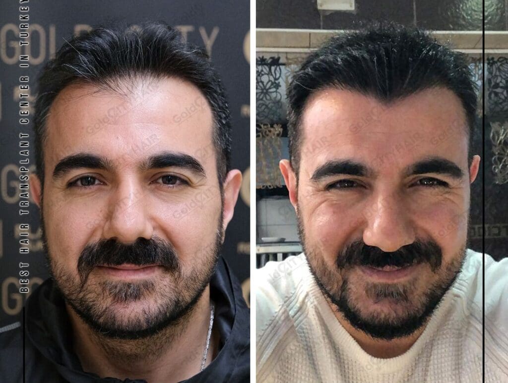 One Stop Hair Premium Hair Extensions Solutions