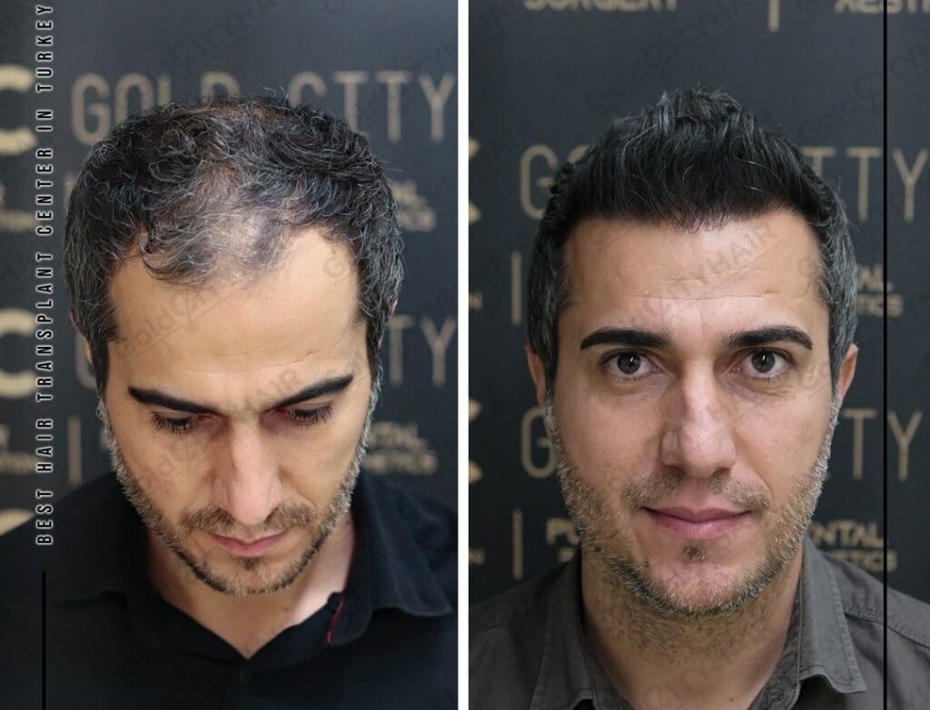 How to Grow Your Hair Faster 10 Proven Tips