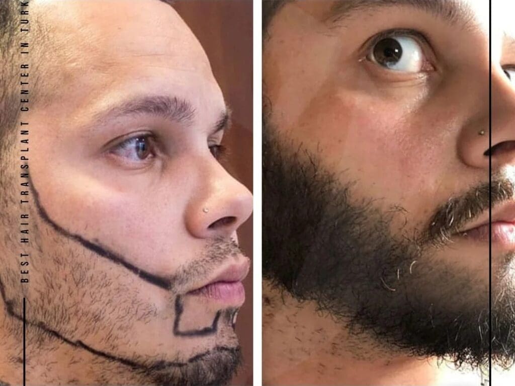 Top Natural Home Remedies to Stop Scalp Itching