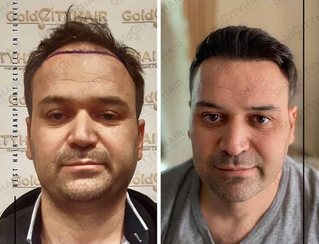 Effective Dry Damaged Hair Treatment Methods