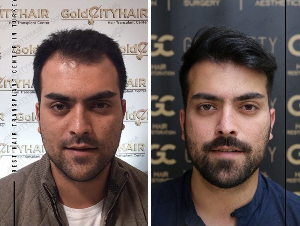 Effective Strategies to Maximize Hair Growth in Seven Days