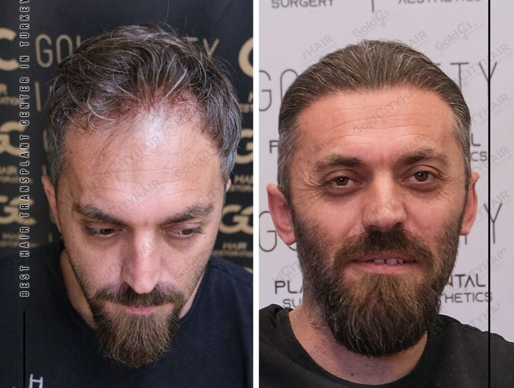 Top Of My Head Tender: Amazing Fix