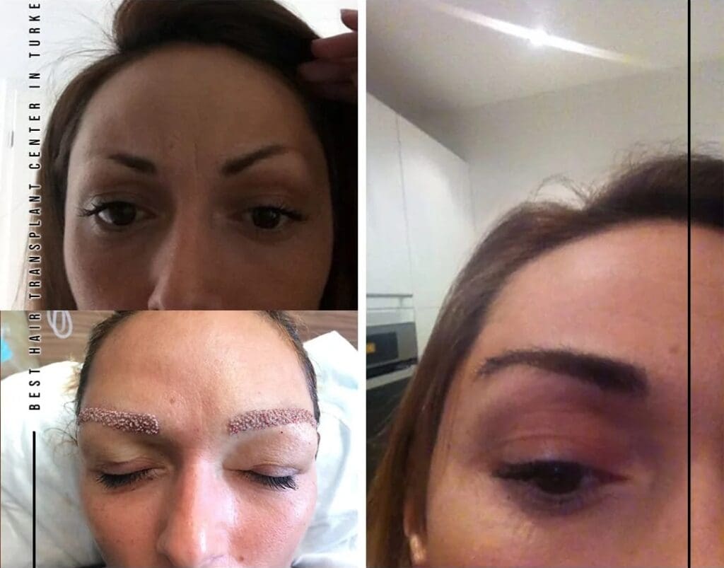 Understanding How Long Does Hair Grow in a Week