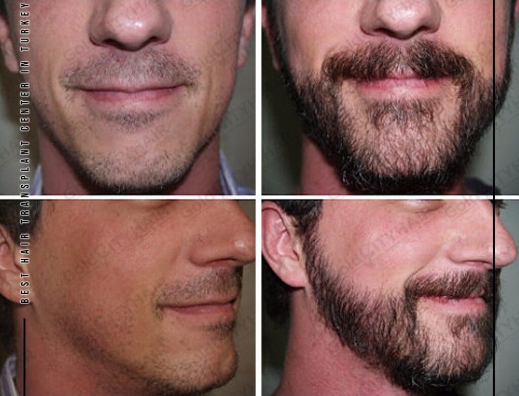 Hair Get Oily: Amazing Easy Fix Win