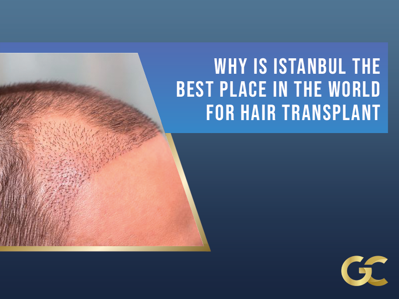 Why Is Istanbul The Best Place In The World For Hair Transplant Gold City Best Hair