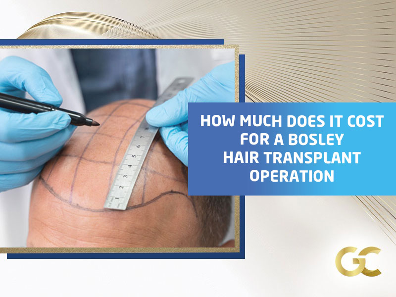 How Much Does A Hair Transplant Cost At Bosley