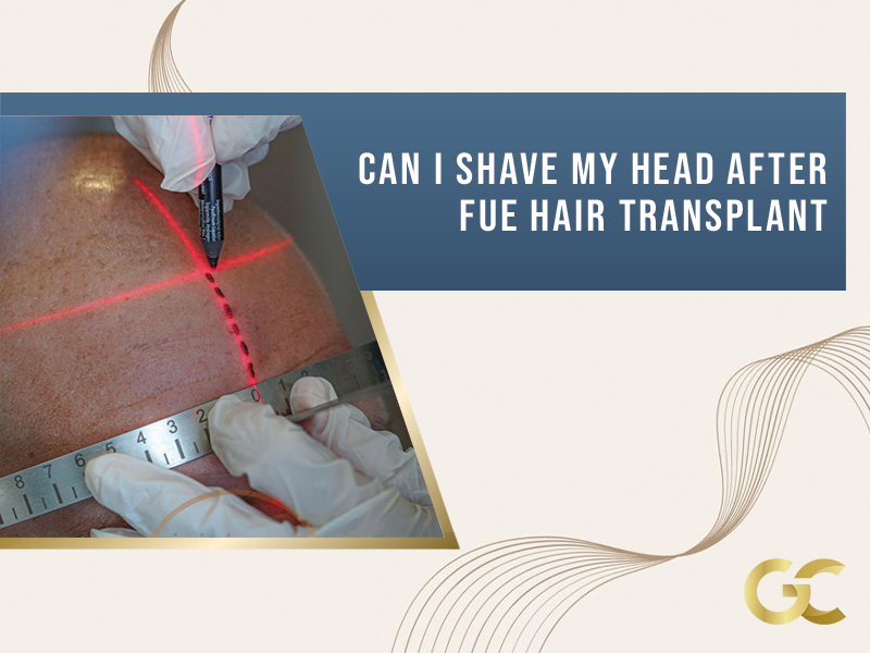 Can I Shave My Head After Fue Haİr Transplant Gold City Best Hair Transplant Turkey 