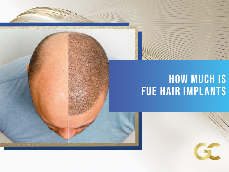 Types of Hair Transplants - Gold City Best Hair Transplant Turkey