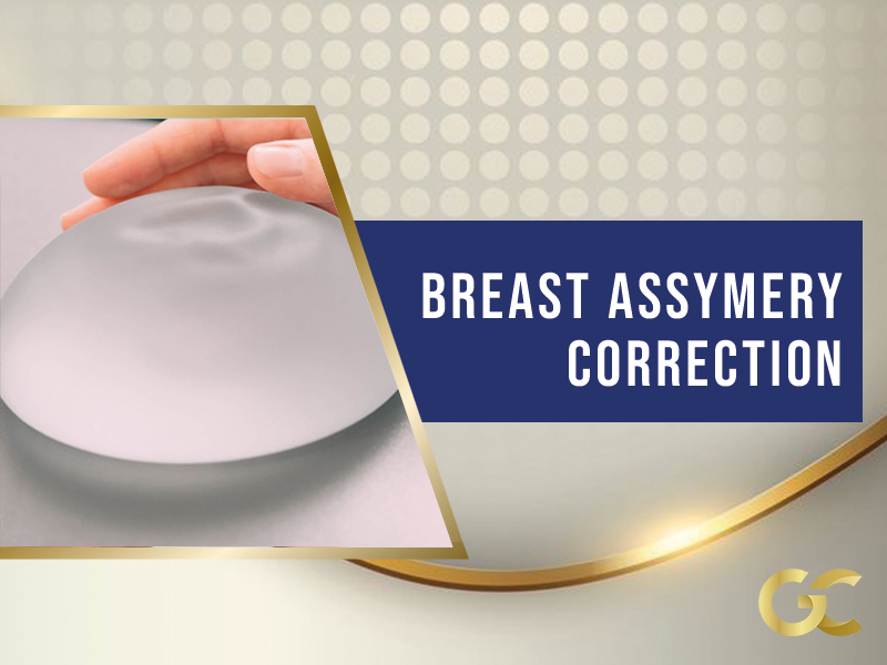 Breast Asymmetry Correction Gold City Best Hair Transplant Turkey