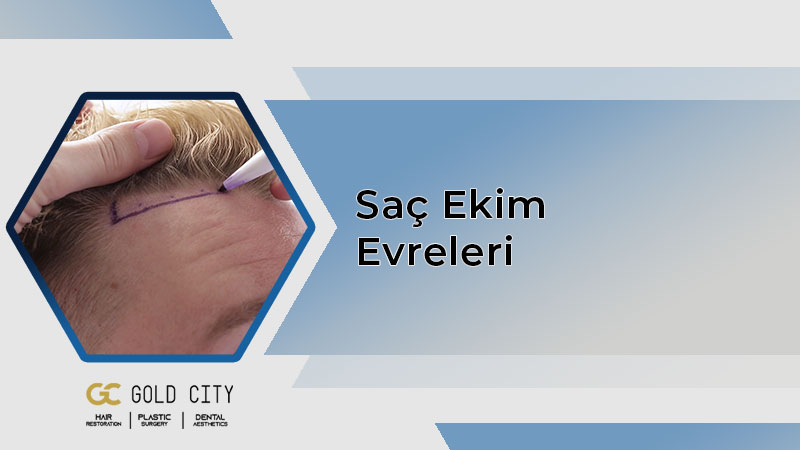 sac-ekim-evreleri