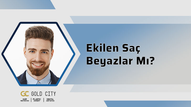 ekilen-sac-beyazlar-mi