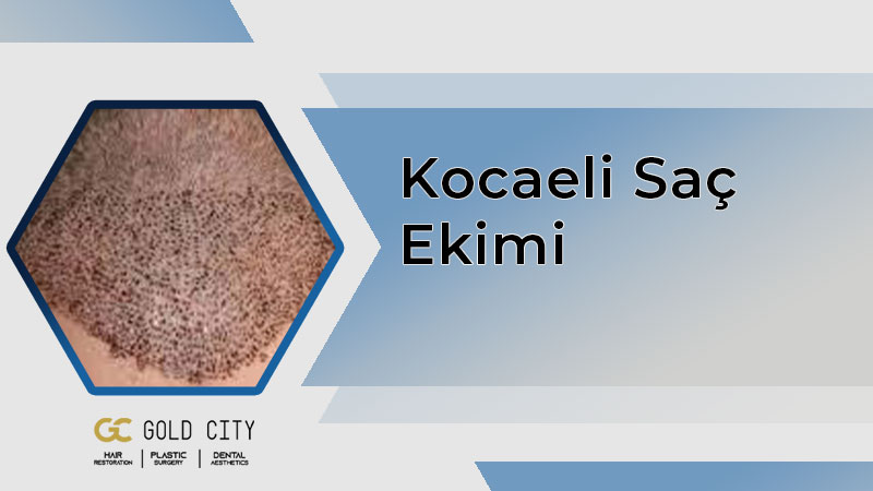 kocaeli-sac-ekimi