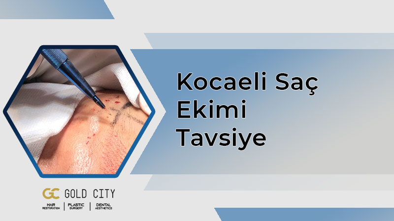 kocaeli-sac-ekimi-tavsiye