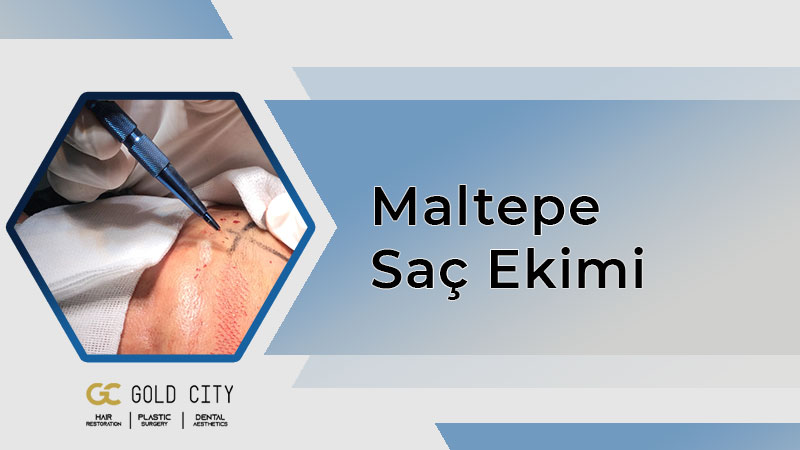 maltepe-sac-ekimi