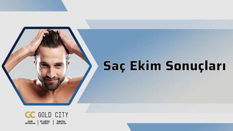 sac-ekim-sonuclari