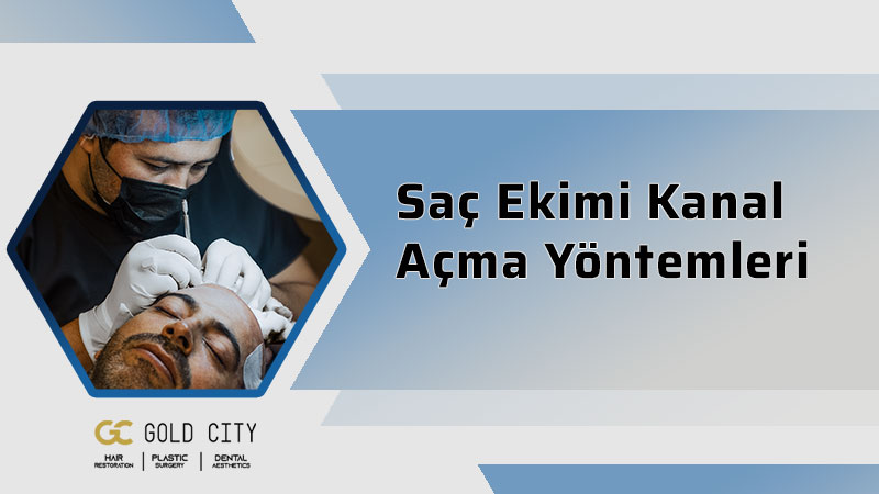 Saç Ekimi Kanal Açma Yöntemleri