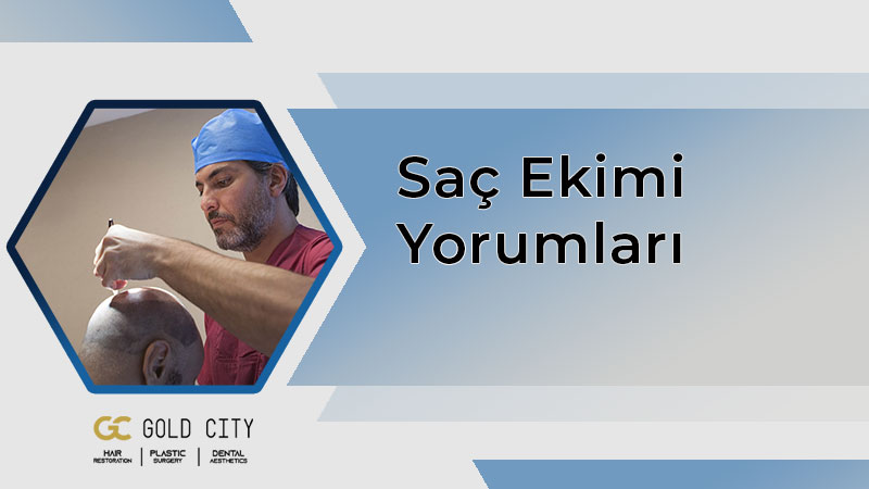 sac-ekimi-yorumlari