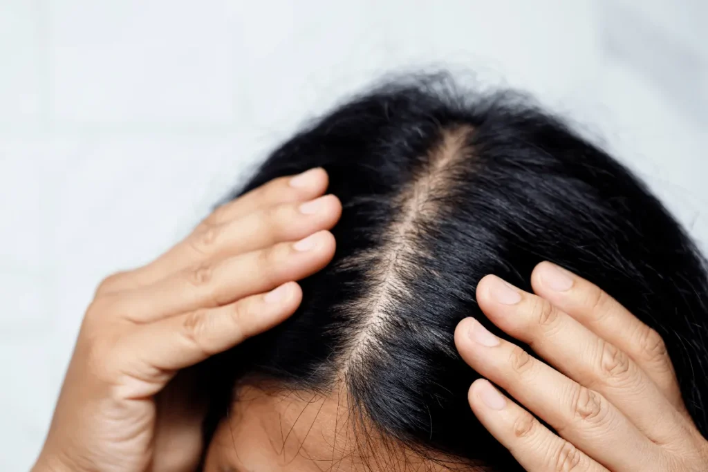 Genetic influences on hair follicles