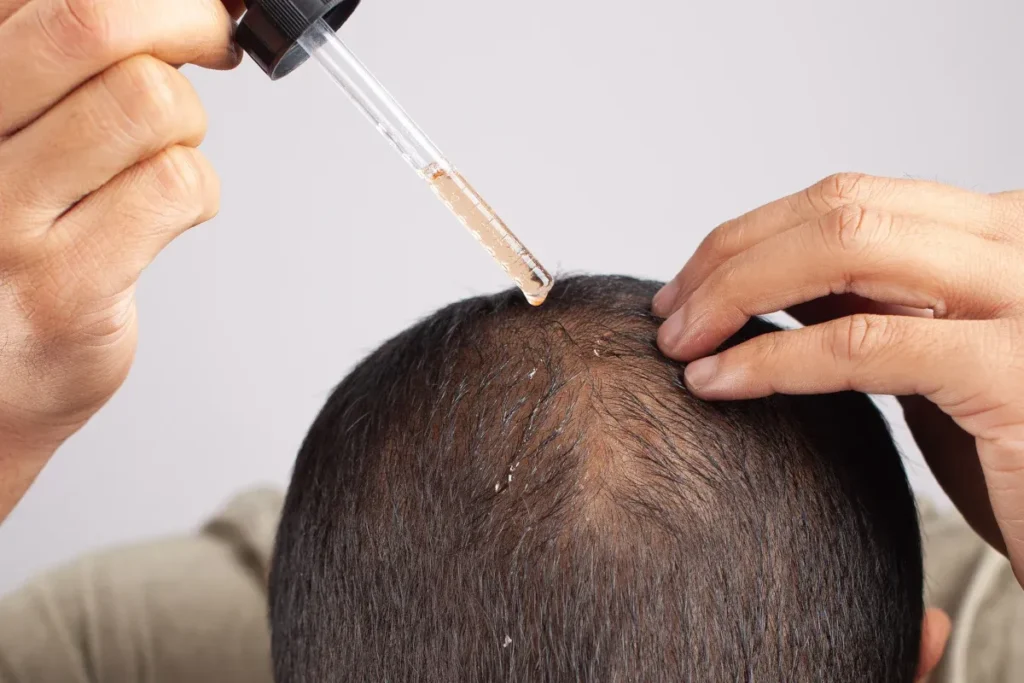 State‑of‑the‑art non surgical hair treatment environment