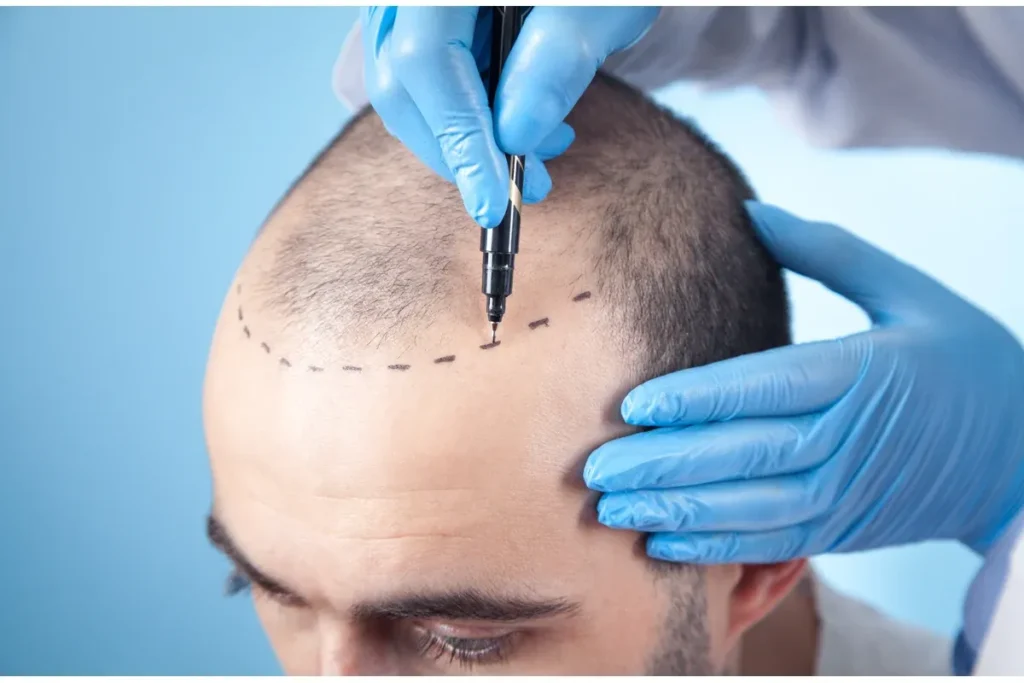 State‑of‑the‑art clinic where Neograft procedures are performed