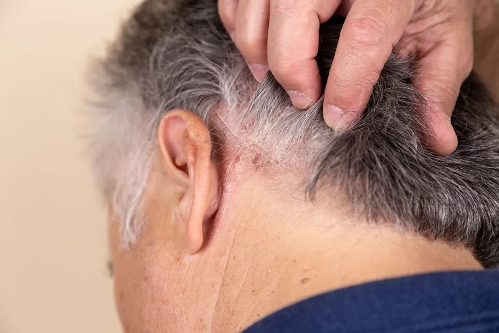 State‑of‑the‑art facility for hair plug procedures