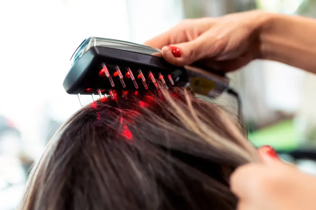 A patient undergoing laser hair restoration