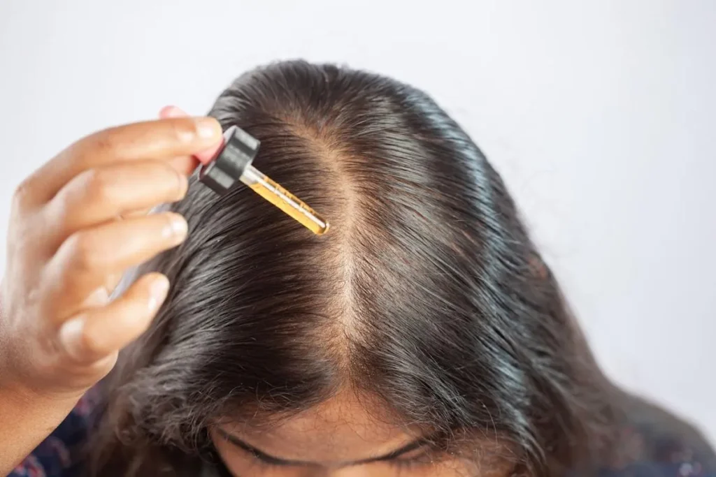 Hair Regrowth