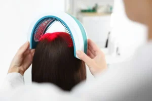 Red light therapy cap delivering therapeutic wavelengths to the scalp