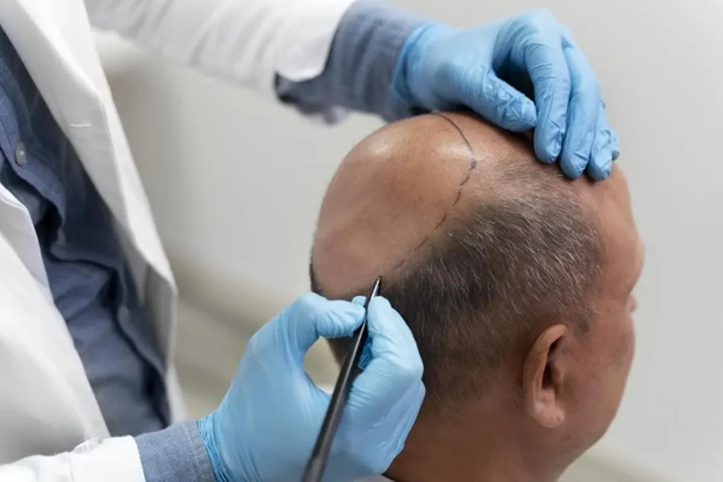 State‑of‑the‑art facilities for hair restoration