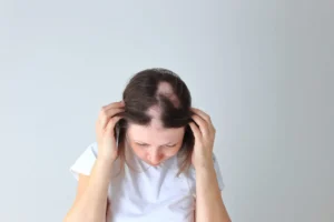 Common causes of hair loss