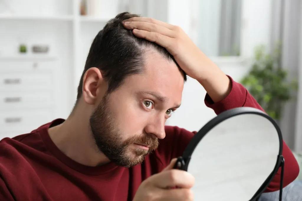 Understanding the Science Behind Hair Loss