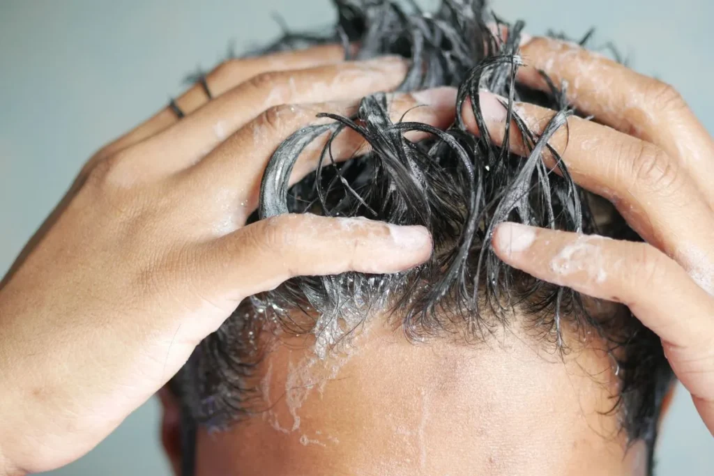 Antifungal Shampoo For Scalp: 5 Fast Wins