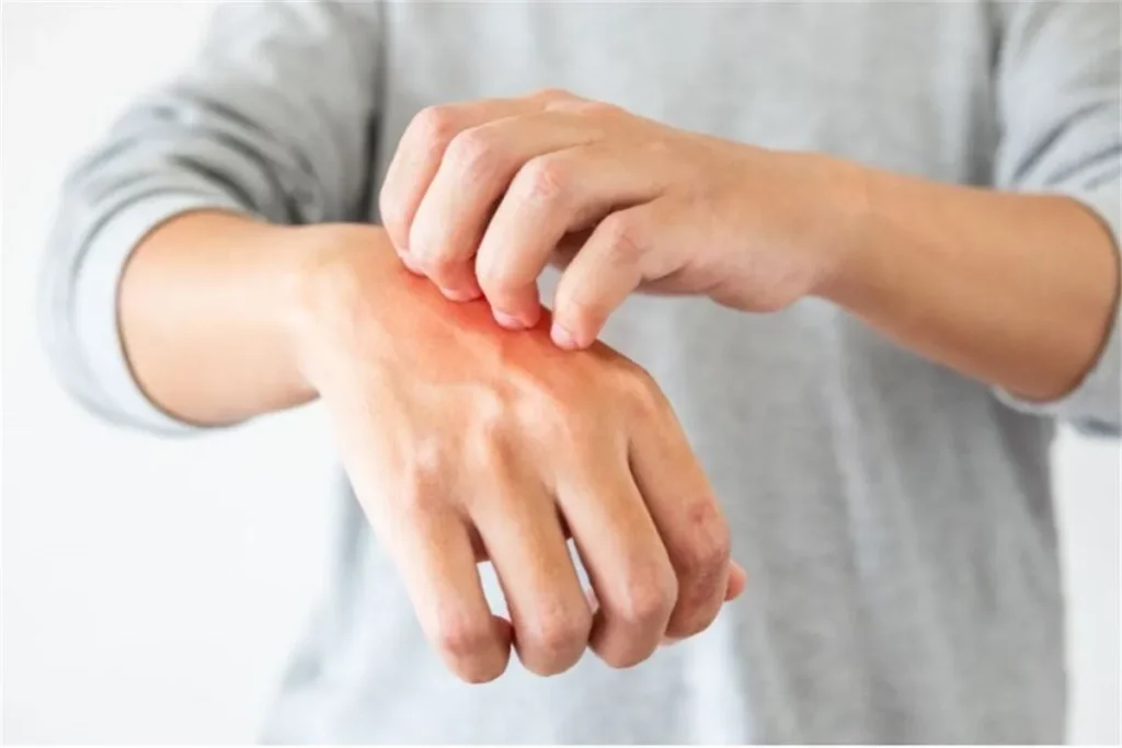 Understanding the Connection Between Itchy Skin and Cancer