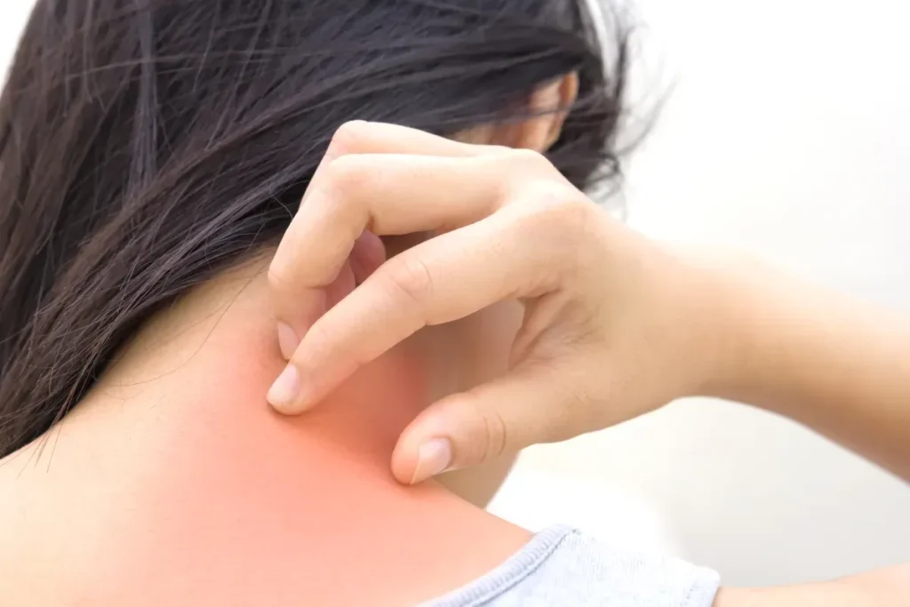 The Science Behind Itchy Skin and Scratching