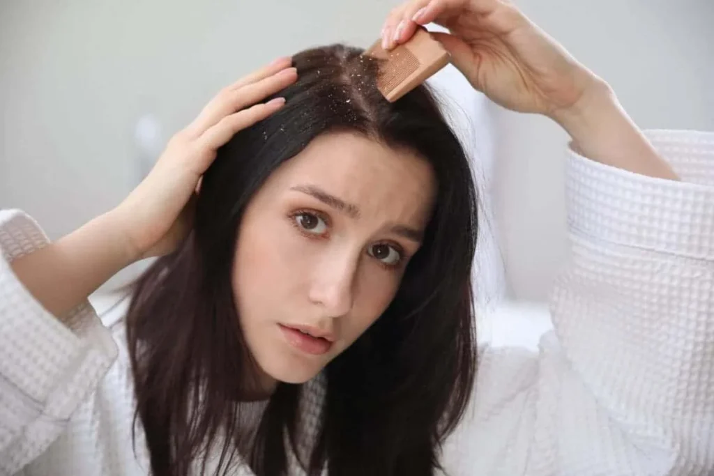 How to Stop Hair Loss as a Teenager Natural Solutions