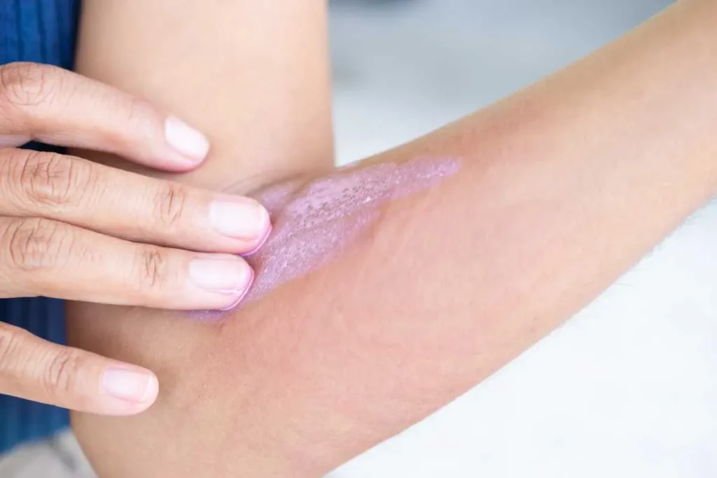 Understanding Skin Rashes and Their Causes