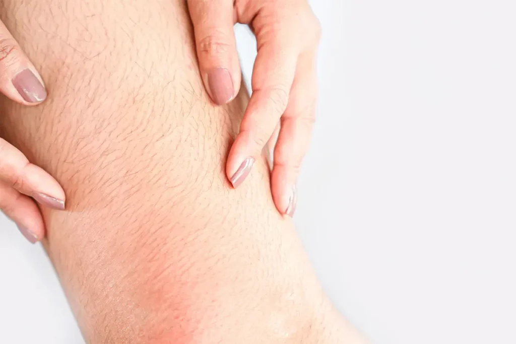 Understanding Age-Related Leg Hair Loss