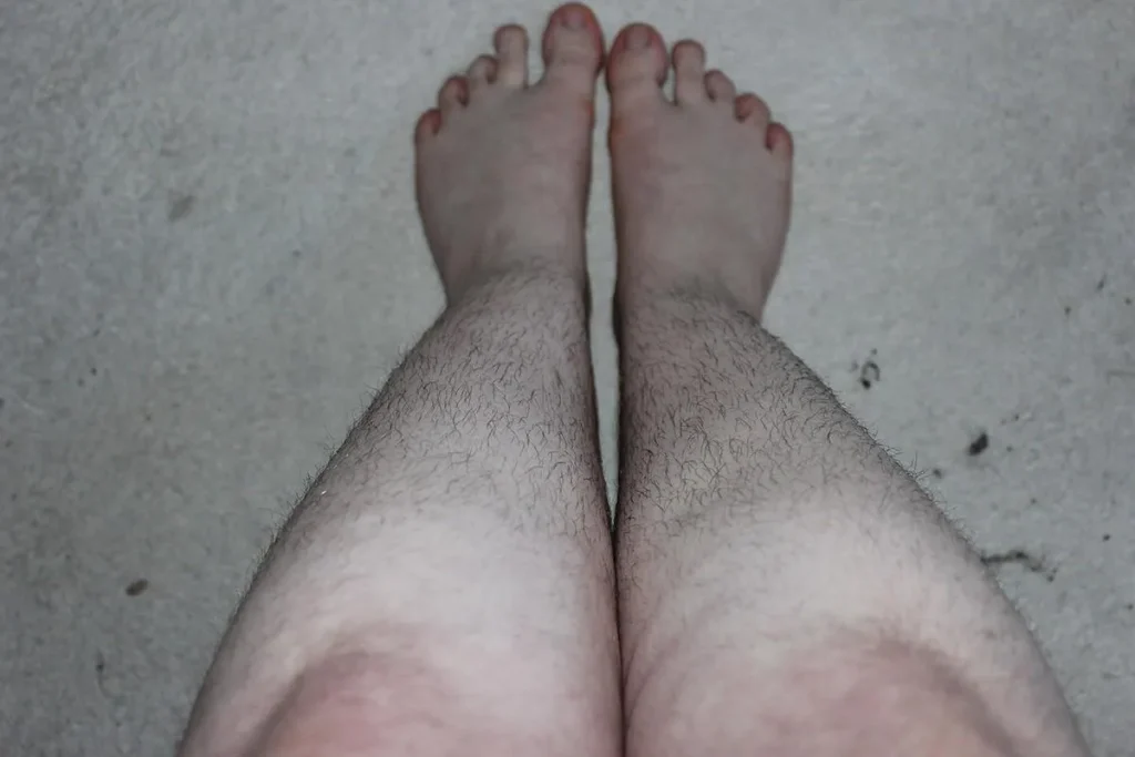 Primary Causes of Diminishing Leg Hair
