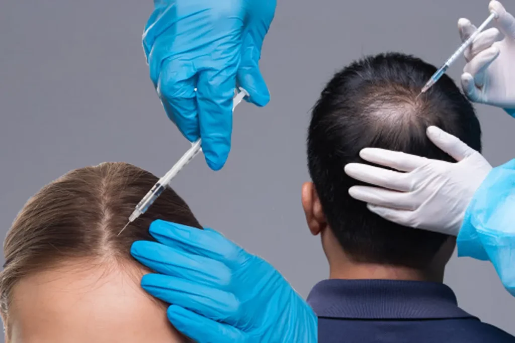 Can Levothyroxine Cause Hair Loss? Fast Fix