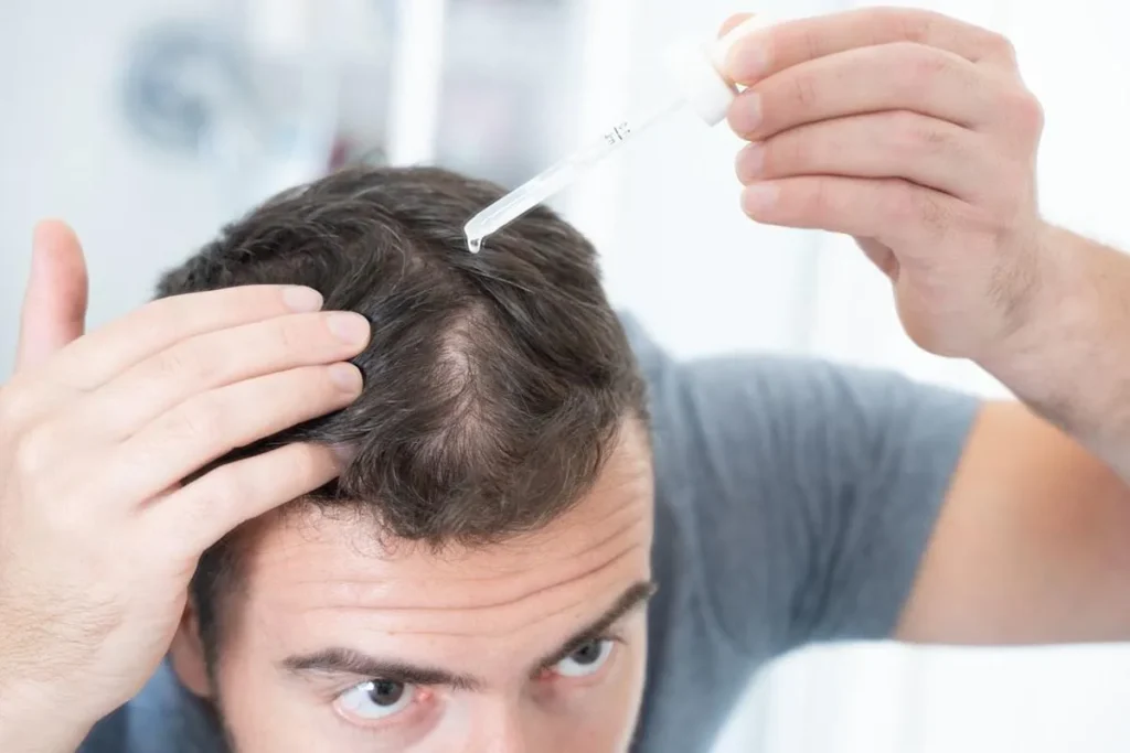 How Dutasteride for Hair Loss Works