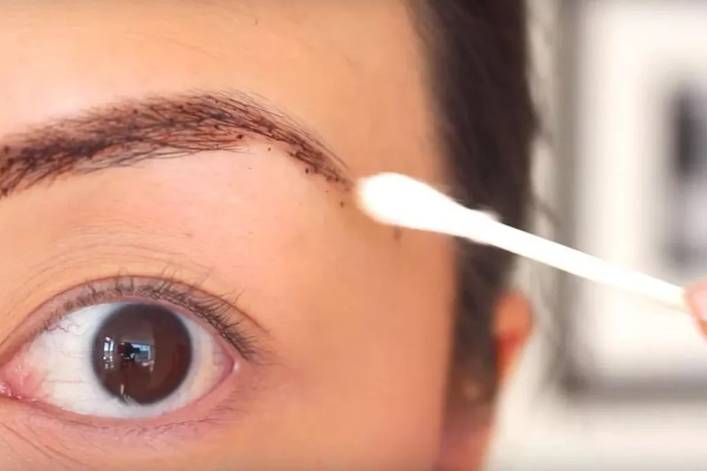 Eyebrow Dandruff: 5 Fast Incredible Cures