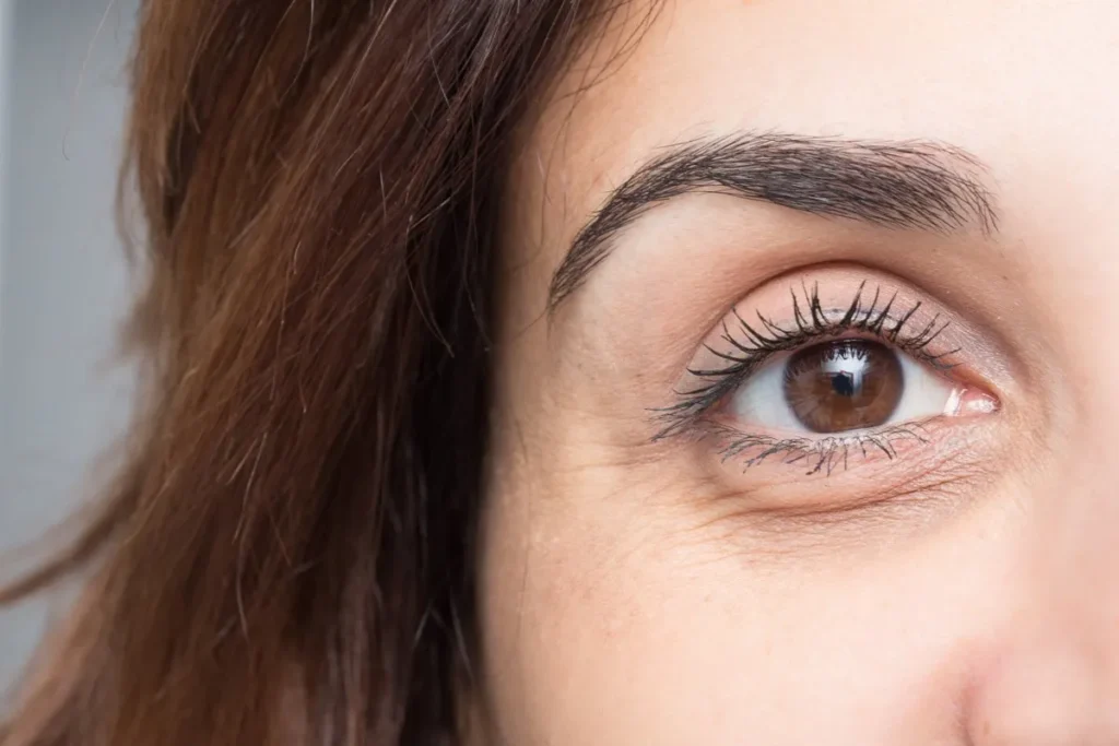 Dry Skin Under Eyebrows: 7 Amazing Fixes